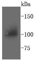 PYK2 Rabbit mAb