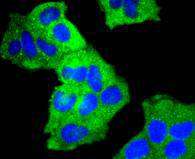 Cortactin Rabbit mAb