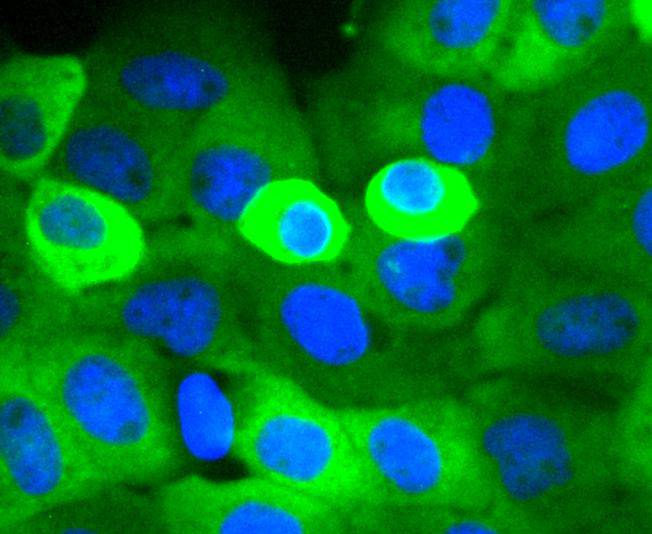 Cortactin Rabbit mAb