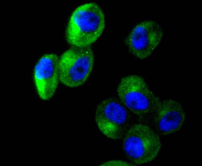 Cortactin Rabbit mAb