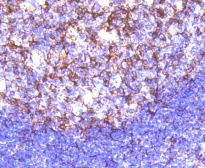 Cortactin Rabbit mAb