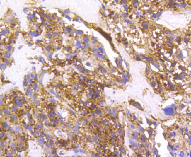 Cortactin Rabbit mAb