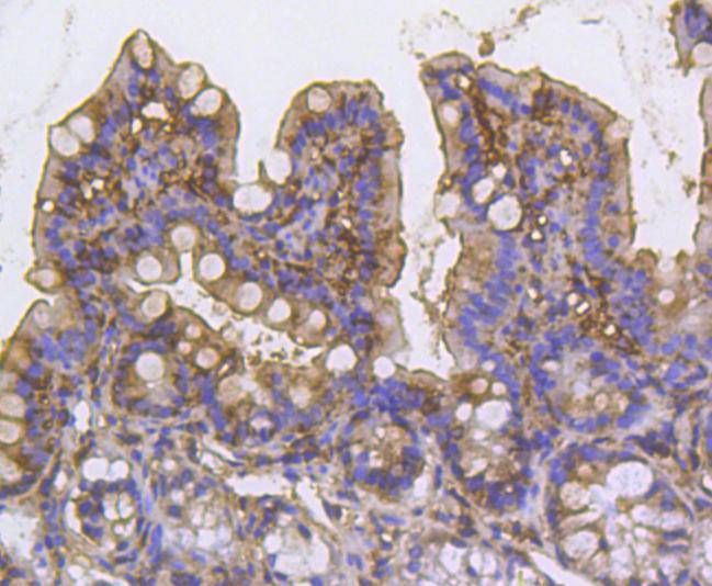 Cortactin Rabbit mAb