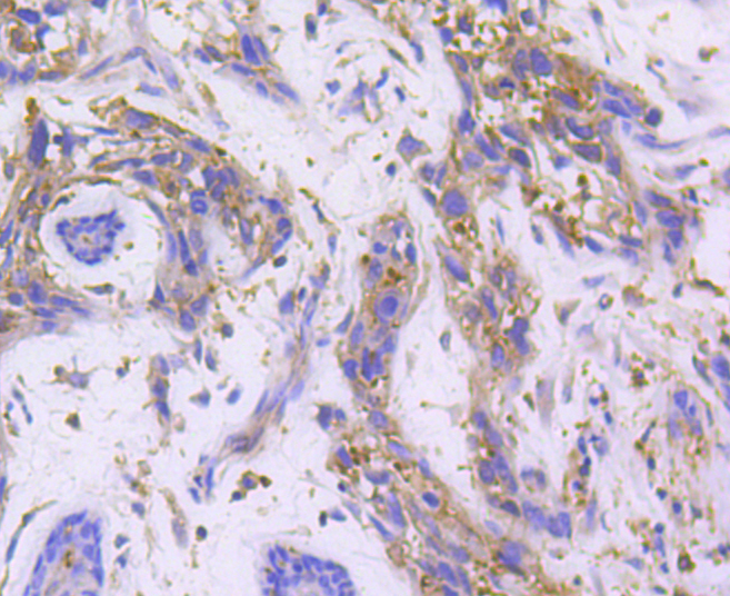 RALBP1 Rabbit mAb