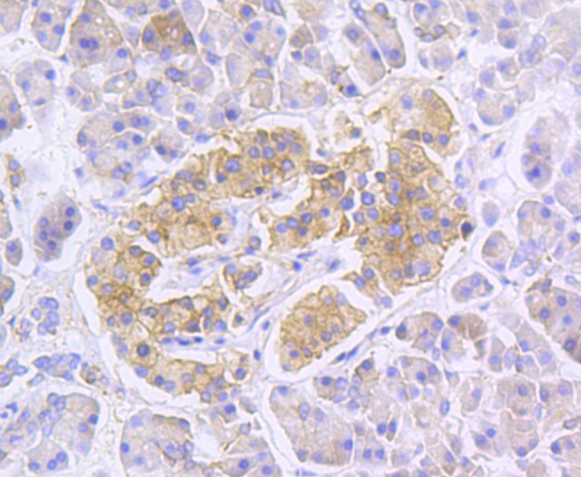 RALBP1 Rabbit mAb