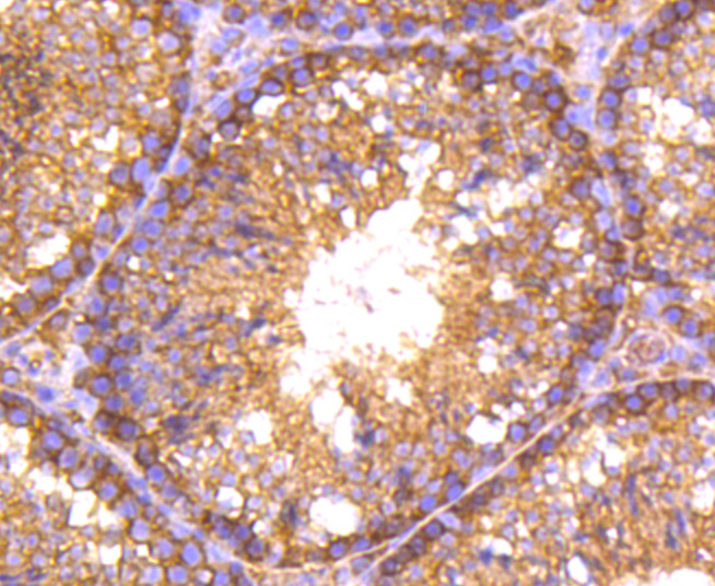 RALBP1 Rabbit mAb