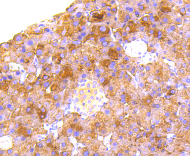 RALBP1 Rabbit mAb