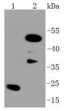 C/EBP Beta Rabbit mAb