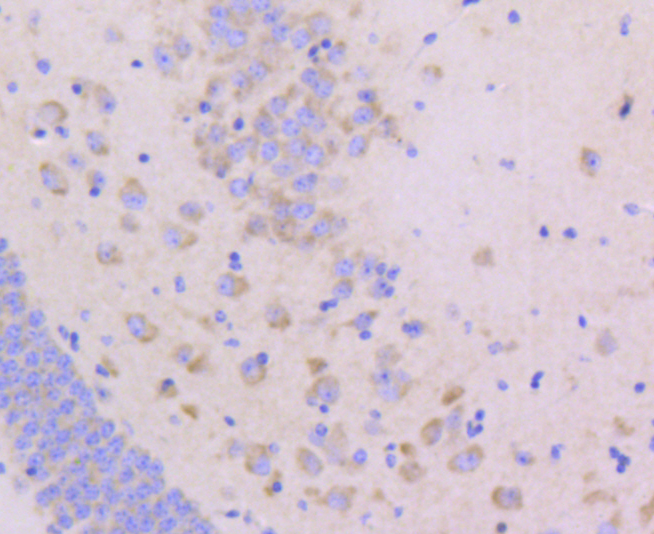 Junctional Adhesion Molecule 1 Rabbit mAb