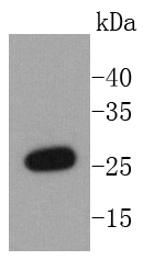 NQO2 Rabbit mAb