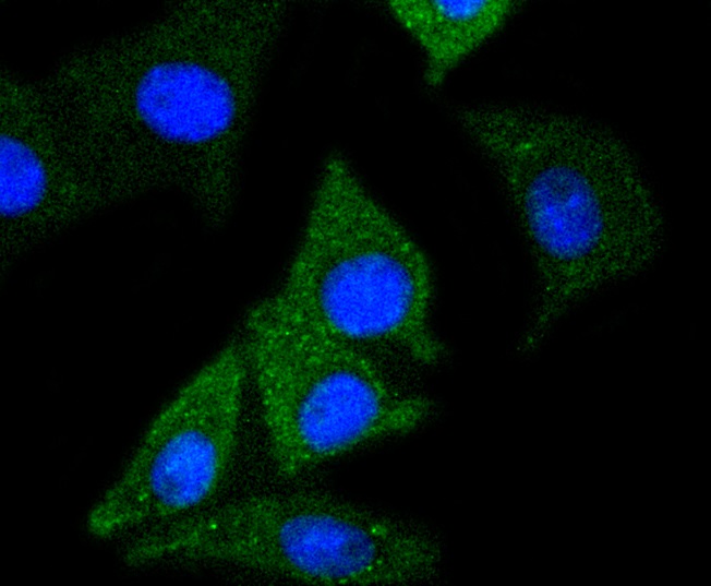 NSE Rabbit mAb