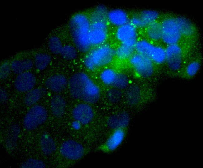 NSE Rabbit mAb