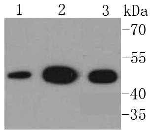 NSE Rabbit mAb