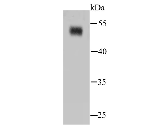 NSE Rabbit mAb