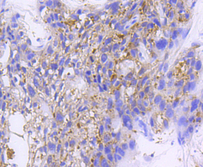 IKB beta Rabbit mAb