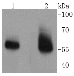 IRAKM Rabbit mAb