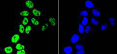 hnRNP C1+C2 Rabbit mAb