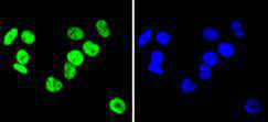 hnRNP C1+C2 Rabbit mAb