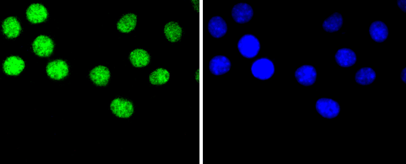 hnRNP C1+C2 Rabbit mAb