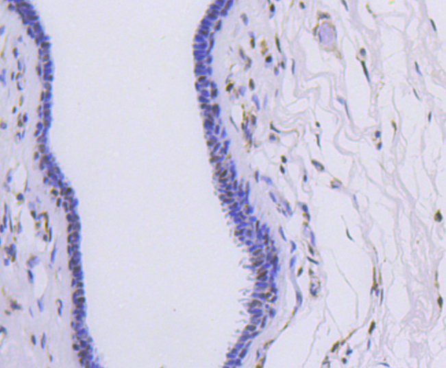 hnRNP C1+C2 Rabbit mAb