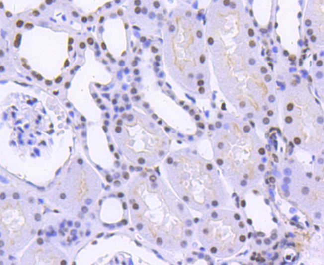 hnRNP C1+C2 Rabbit mAb