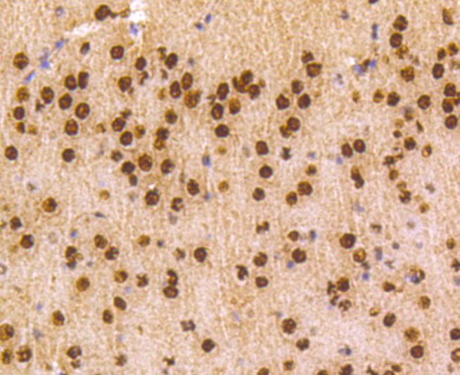 hnRNP C1+C2 Rabbit mAb