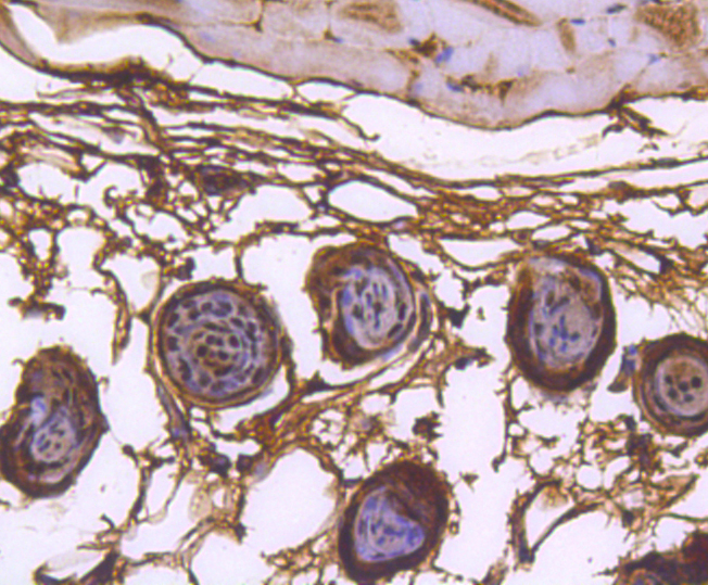 hnRNP C1+C2 Rabbit mAb