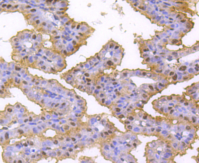 hnRNP C1+C2 Rabbit mAb