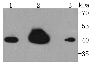 hnRNP C1+C2 Rabbit mAb