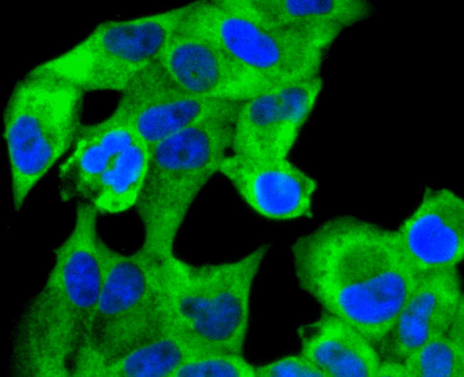 RAD18 Rabbit mAb