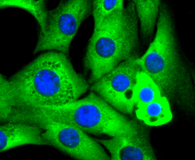 RAD18 Rabbit mAb