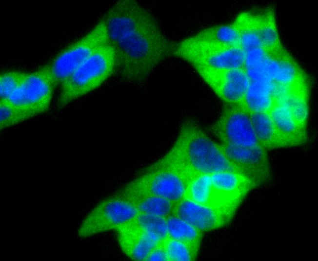 RAD18 Rabbit mAb