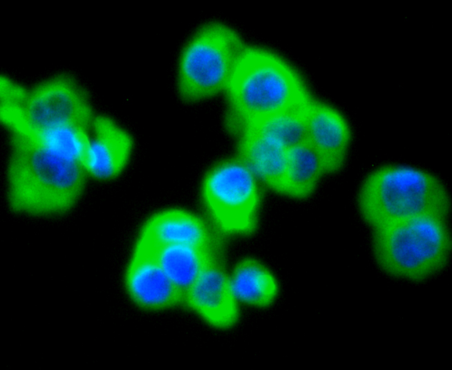 MMP11 Rabbit mAb