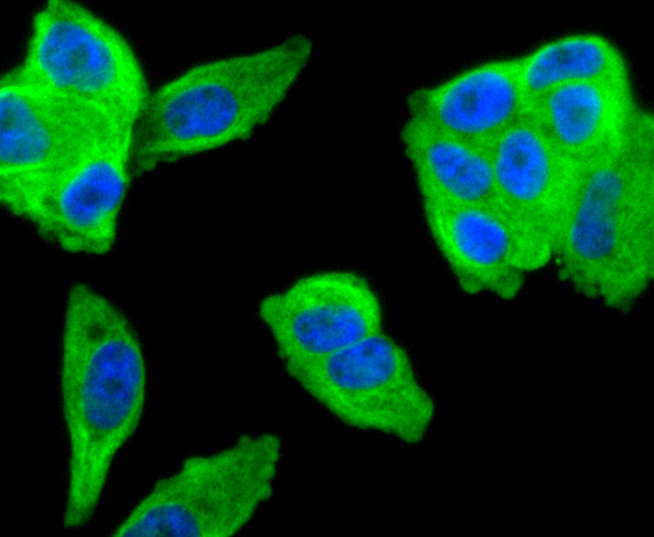 MMP11 Rabbit mAb