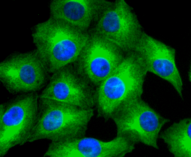 MMP11 Rabbit mAb