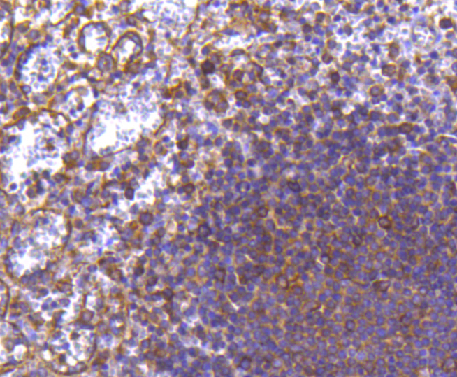 MMP11 Rabbit mAb