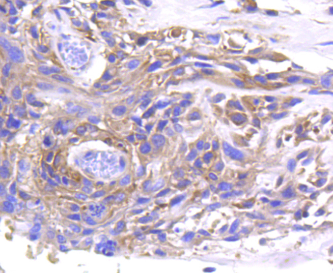 MMP11 Rabbit mAb