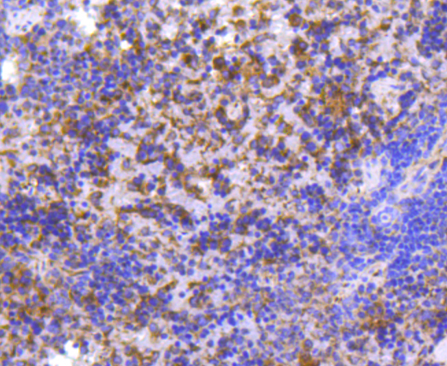 MMP11 Rabbit mAb