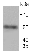 MMP11 Rabbit mAb