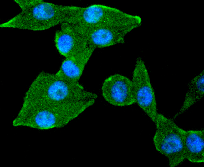 TACC3 Rabbit mAb