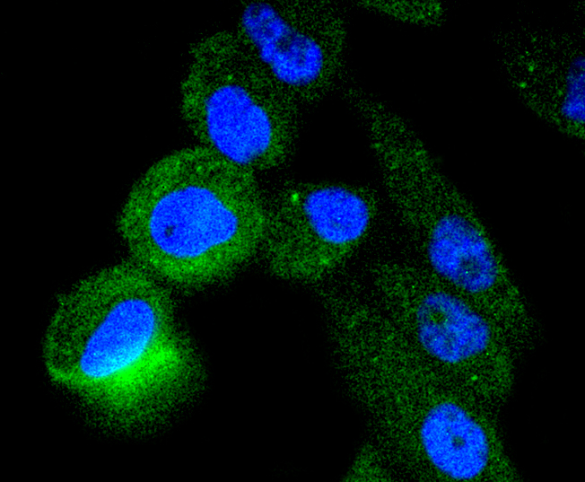 TACC3 Rabbit mAb