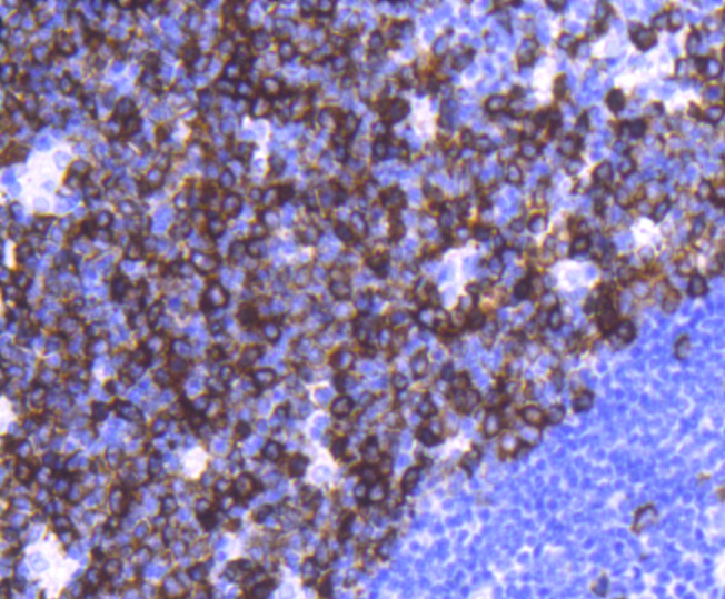 TACC3 Rabbit mAb