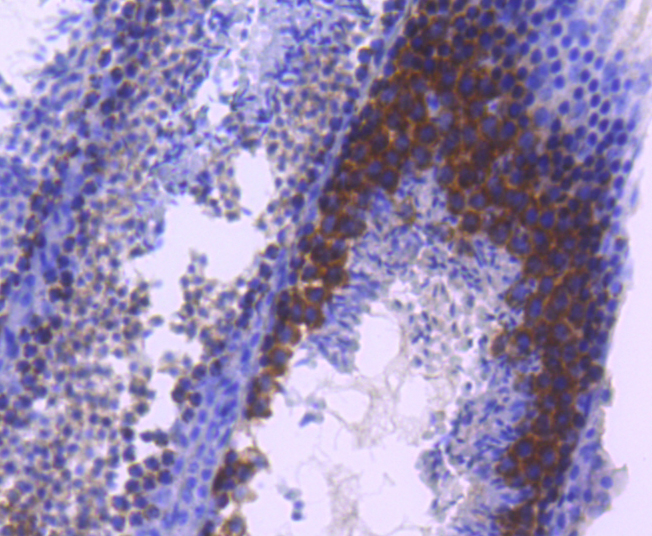 TACC3 Rabbit mAb