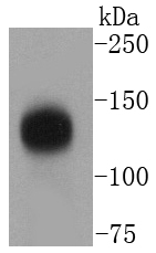 TACC3 Rabbit mAb