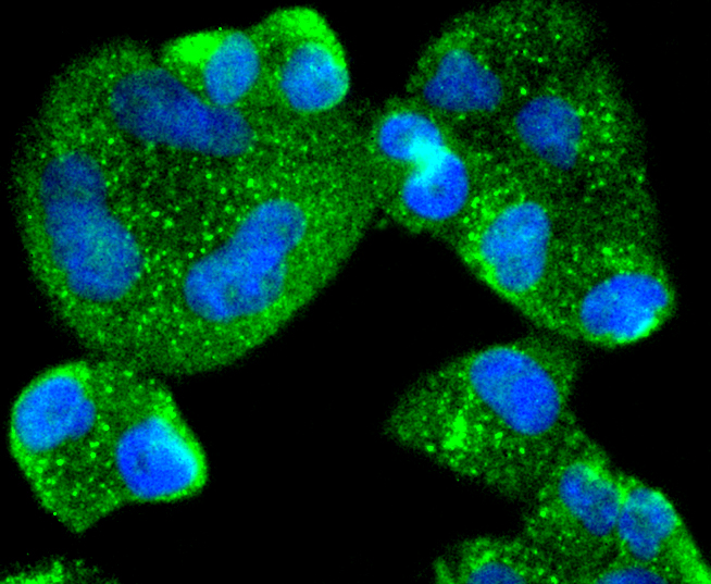 AGR2 Rabbit mAb