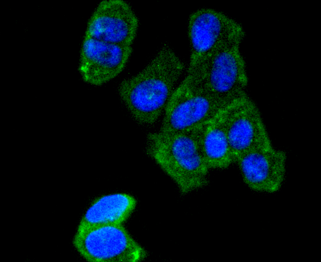 AGR2 Rabbit mAb