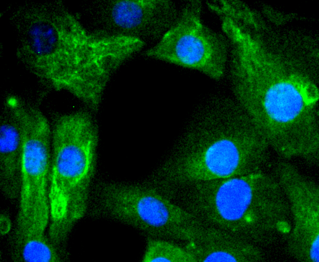 AGR2 Rabbit mAb