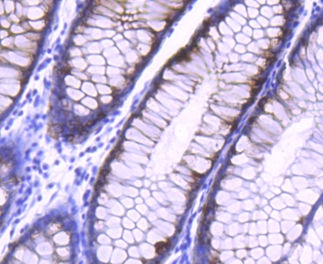 AGR2 Rabbit mAb