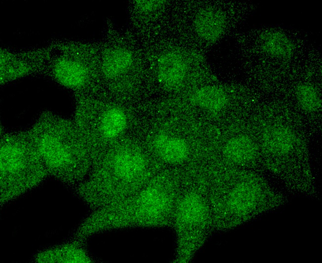 MAP1LC3A Rabbit mAb