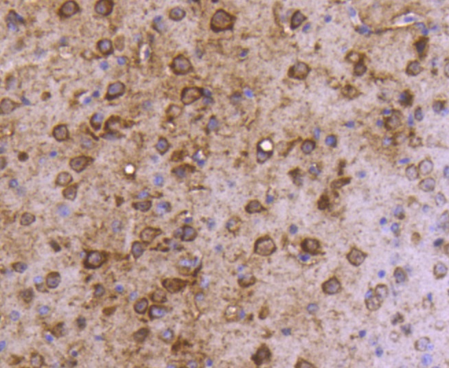 MAP1LC3A Rabbit mAb